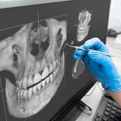Applied Diagnostic Concepts in 3D Orthodontic Imaging and Treatment